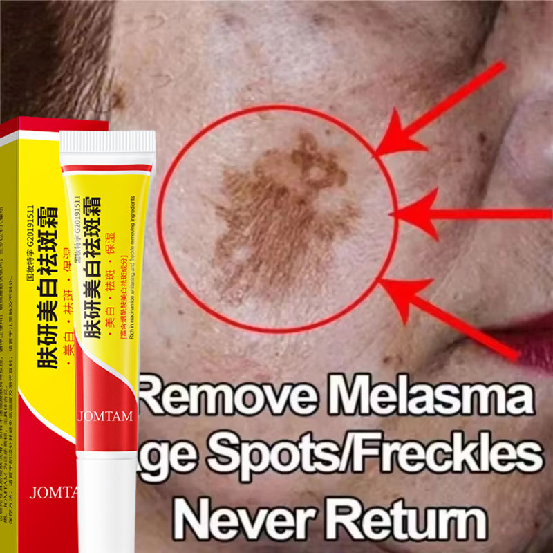 Skincare Niacinamide - كريم تفتيح النمش وتفتيح الوجه بالنياسيناميد