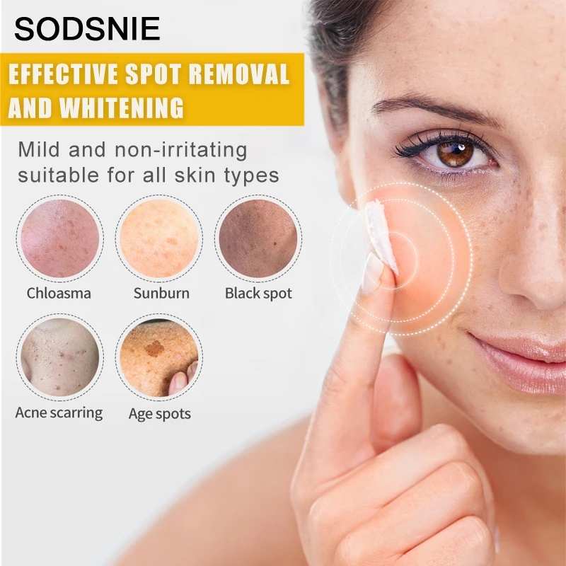 مزيل البقع الداكنة مع فيتامين  - مراجعة Skincare Niacinamide وسعره