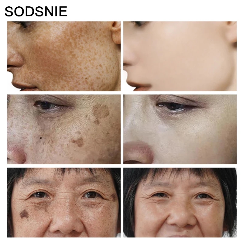 مزيل البقع الداكنة مع فيتامين  - مراجعة Skincare Niacinamide وسعره