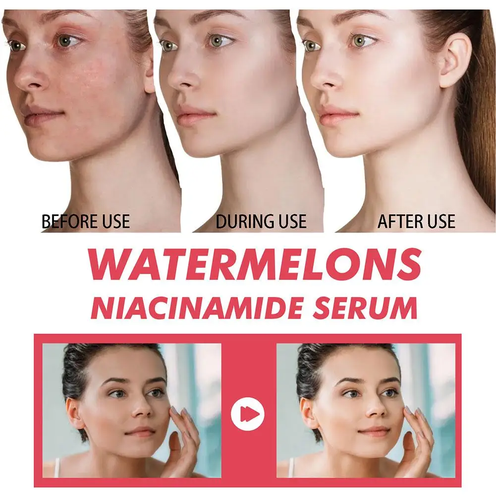 مصل ترطيب النياسيناميد المتوهج - مراجعة Skincare Niacinamide وسعره