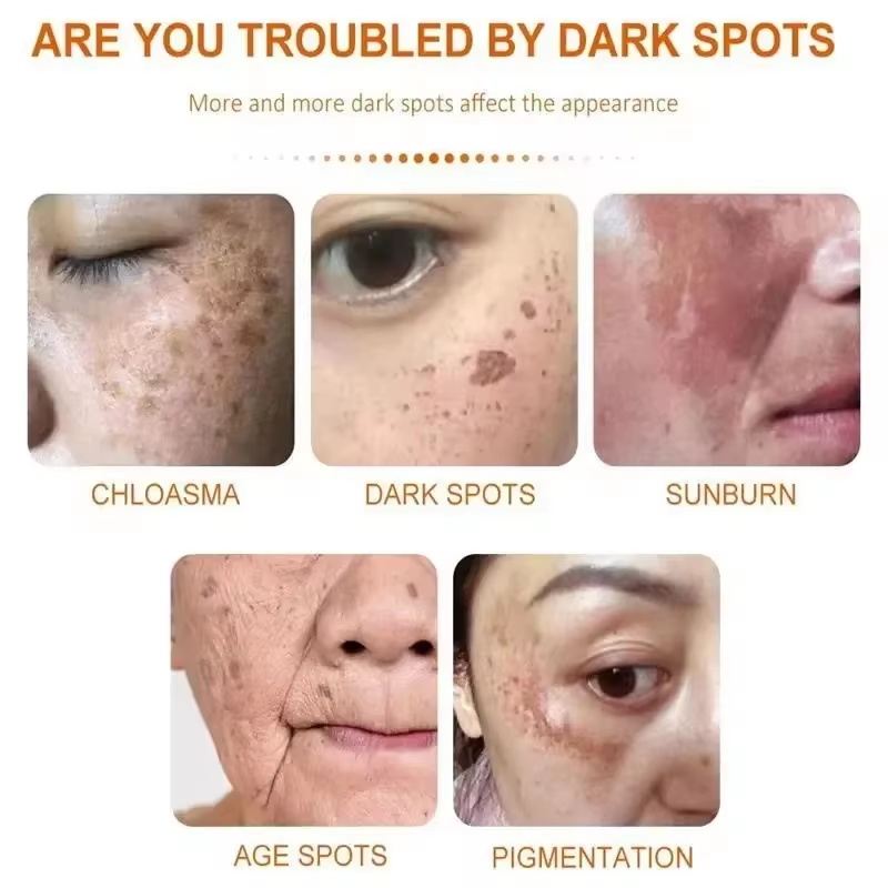 كريم تفتيح النمش وتفتيح الوجه  - مراجعة Skincare Niacinamide وسعره