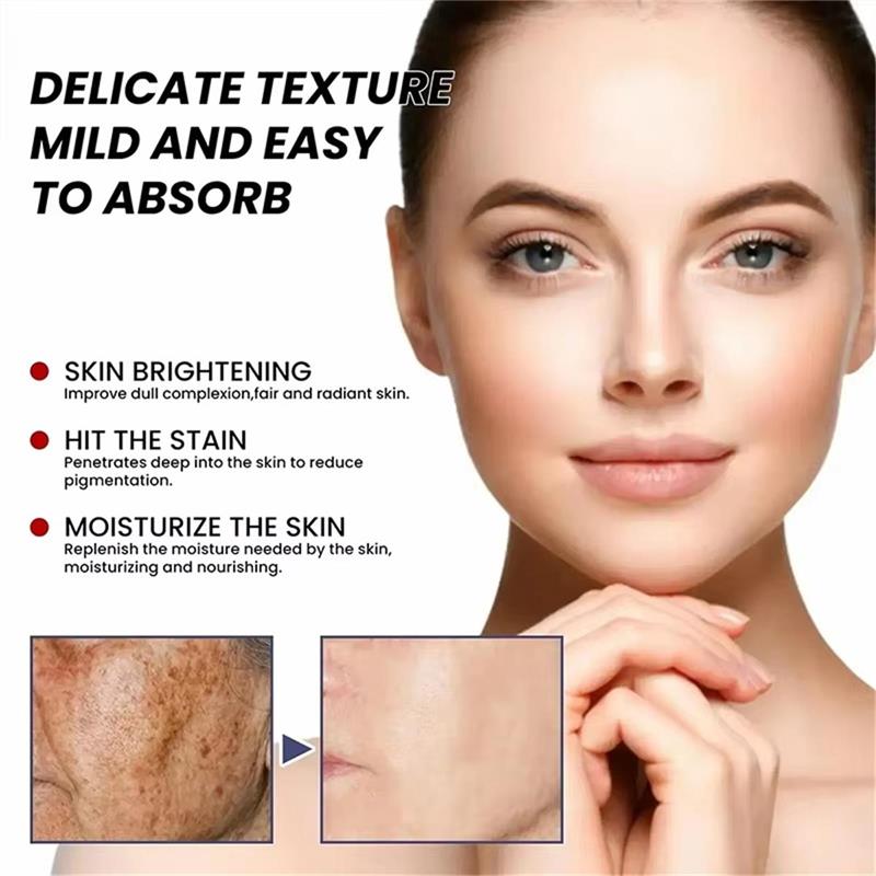 كريم تفتيح النمش وتفتيح الوجه  - مراجعة Skincare Niacinamide وسعره